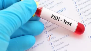آزمایش FSH