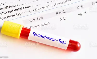 تست تستوسترون چیست