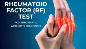 آزمایش RF