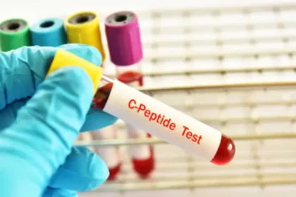 آزمایش c پیتید
