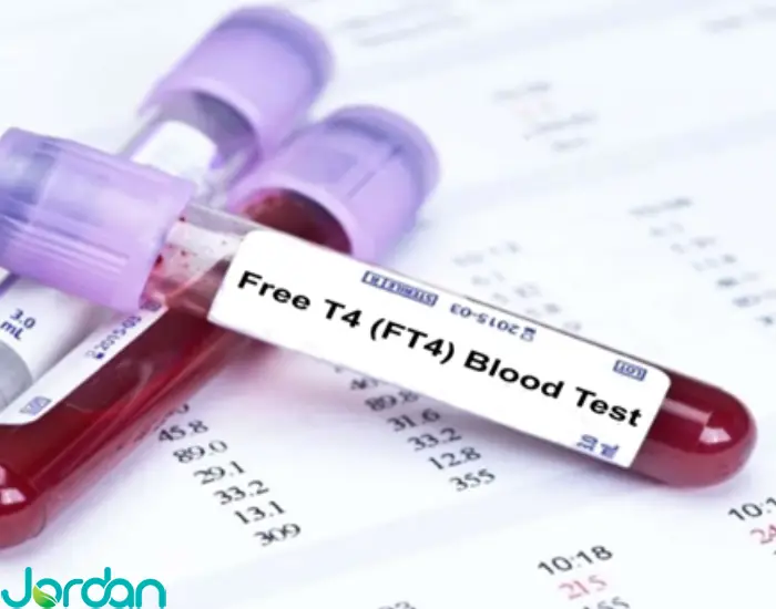 آزمایش Free T4