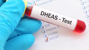 آزمایش S-DHEA