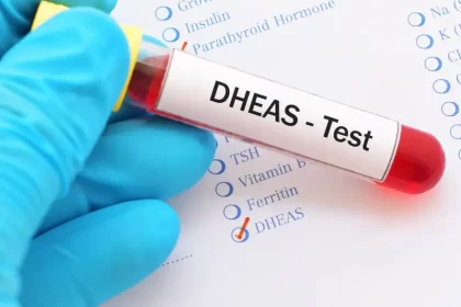آزمایش S-DHEA