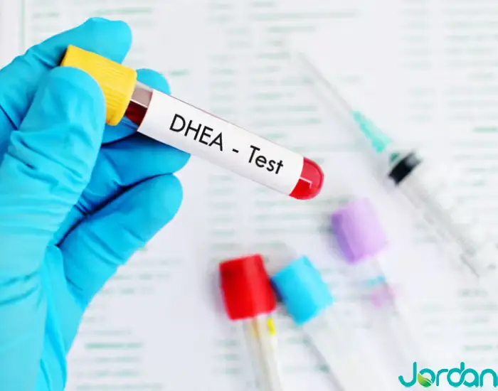 آزمایش S-DHEA