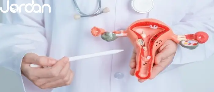 اندومتریوز