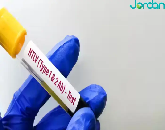 آزمایش HTLV