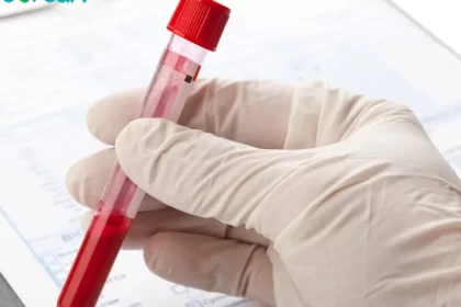 آزمایش آنتی بادی مایکوپلاسما پنومونی