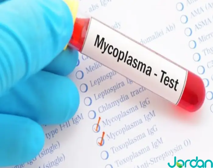 آزمایش آنتی بادی مایکوپلاسما پنومونی