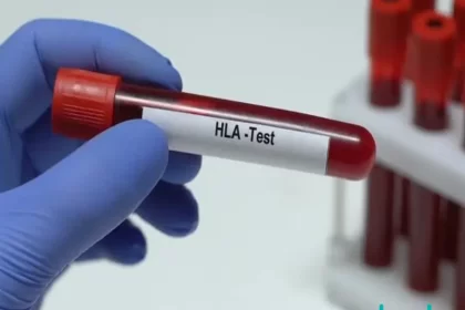 آزمایش آنتی ژن لکوسیت انسانی (HLA)