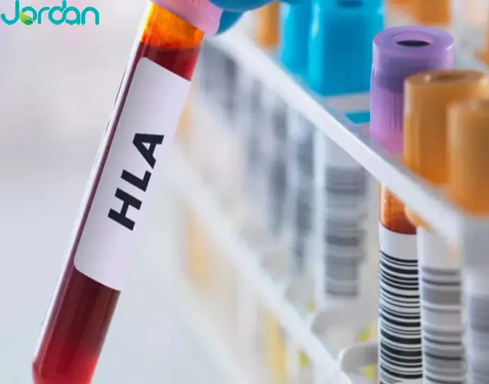 آزمایش آنتی ژن لکوسیت انسانی (HLA)