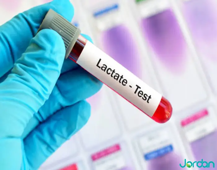 آزمایش لاکتات 