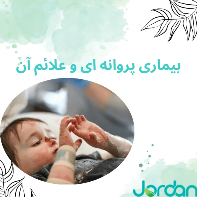 بیماری پروانه ای و علائم آن