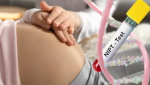 آزمایش NIPT