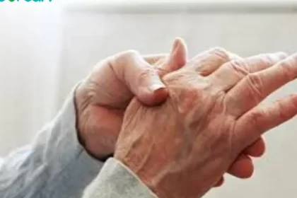بیماری اسکلرودرمی