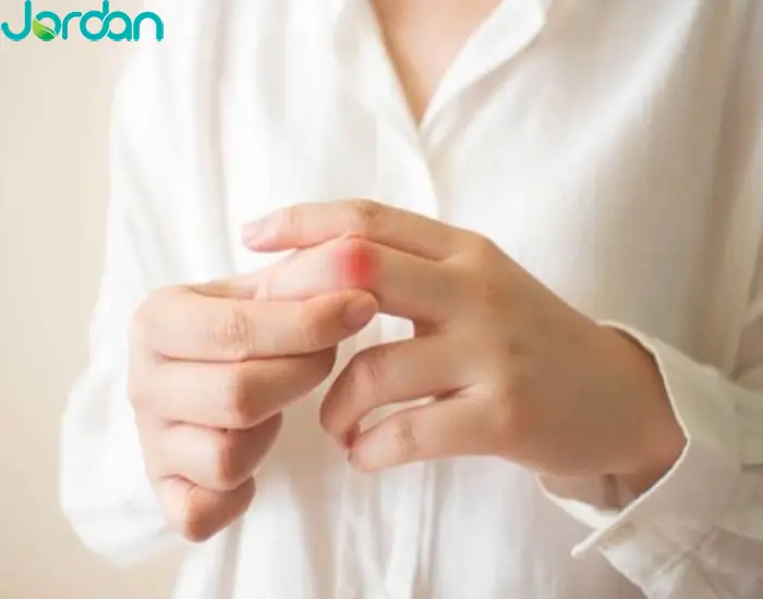 بیماری اسکلرودرمی