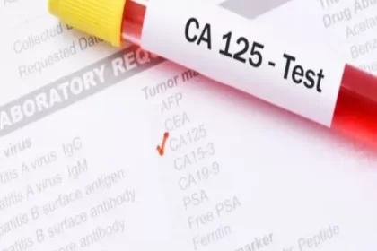 آزمایش خون CA-125