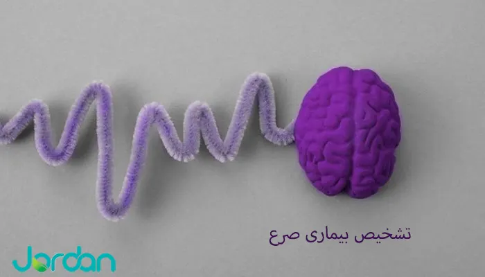 تشخیص بیماری صرع