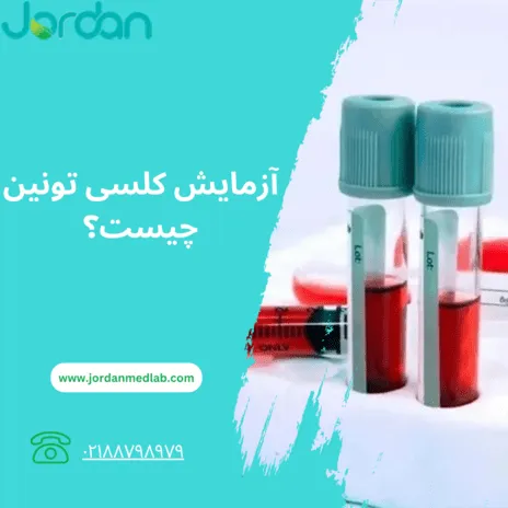آزمایش کلسی تونین