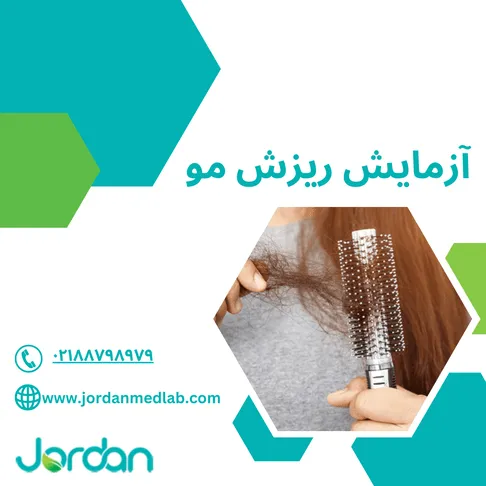 آزمایش ریزش مو
