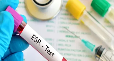 آزمایش ESR آزمایش ESR