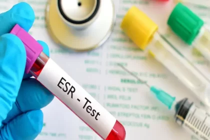 آزمایش ESR