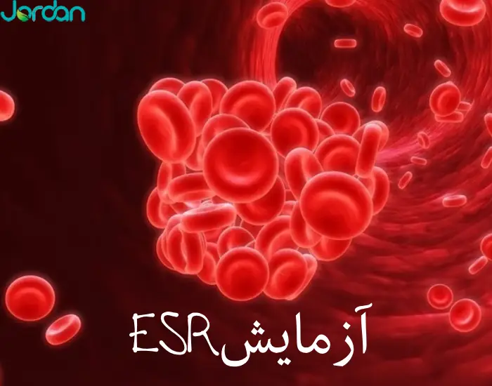 آزمایش ESR