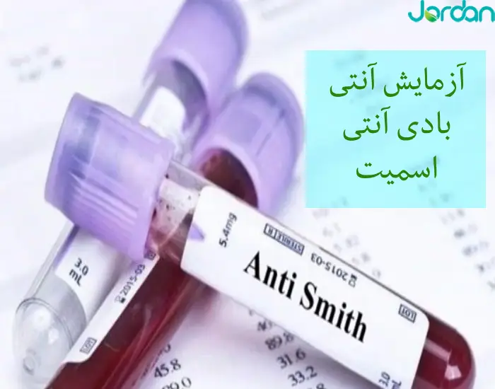 آزمایش آنتی بادی آنتی اسمیت Sm