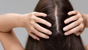  آزمایش ریزش مو