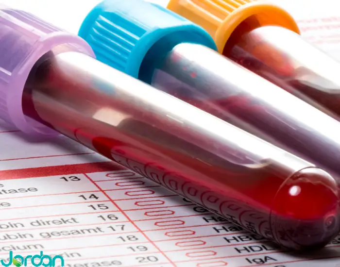 آزمایش شمارش گلبول های سفید