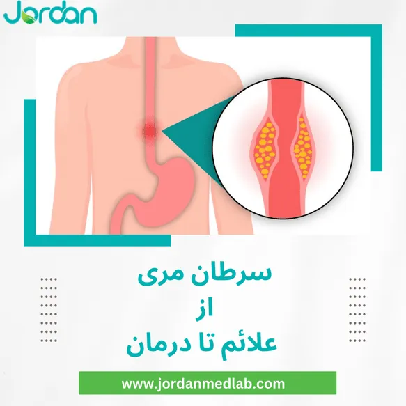 سرطان مری
