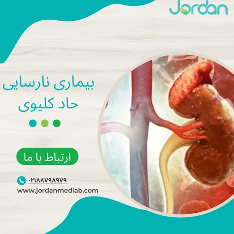 نارسایی حاد کلیوی