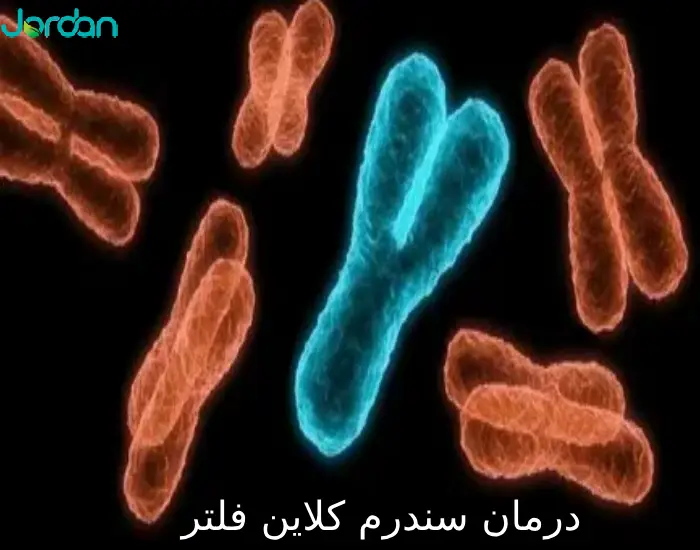 درمان سندرم کلاین فلتر