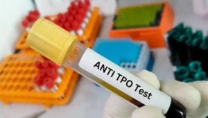 آزمایش anti tpo