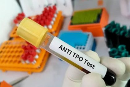 آزمایش anti tpo آزمایش anti tpo