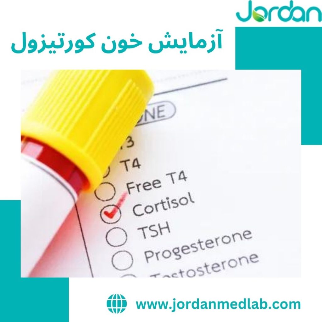 آزمایش خون کورتیزول