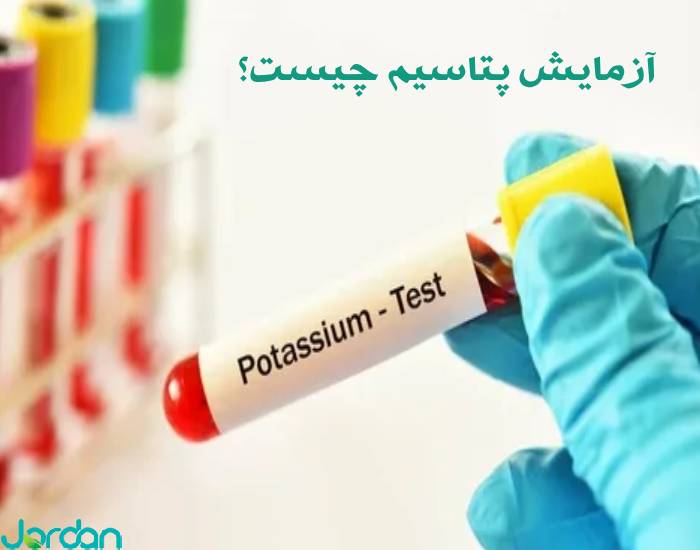 آزمایش پتاسیم