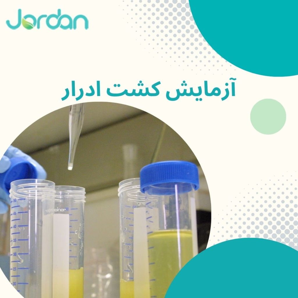 ازمایش کشت ادرار