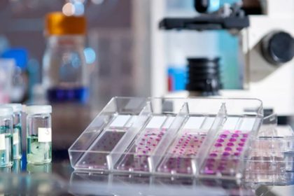 آزمایش IHC