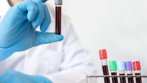 آزمایش الکترولیت خون آزمایش الکترولیت خون