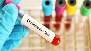 آزمایش کلسترول آزمایش کلسترول