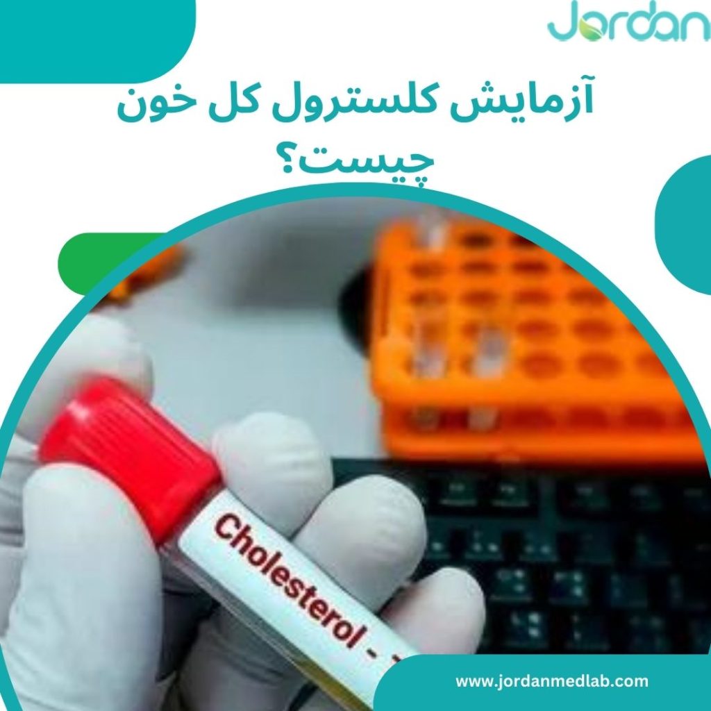 آزمایش کلسترول