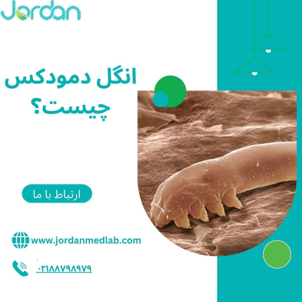 انگل دمودکس