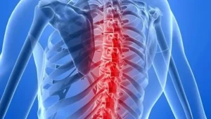 آتروفی عضلانی نخاعی آتروفی عضلانی نخاعی (SMA)