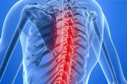 آتروفی عضلانی نخاعی (SMA)