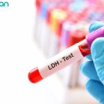 آزمایش لاکتات دهیدروژناز