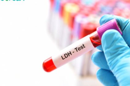آزمایش لاکتات دهیدروژناز