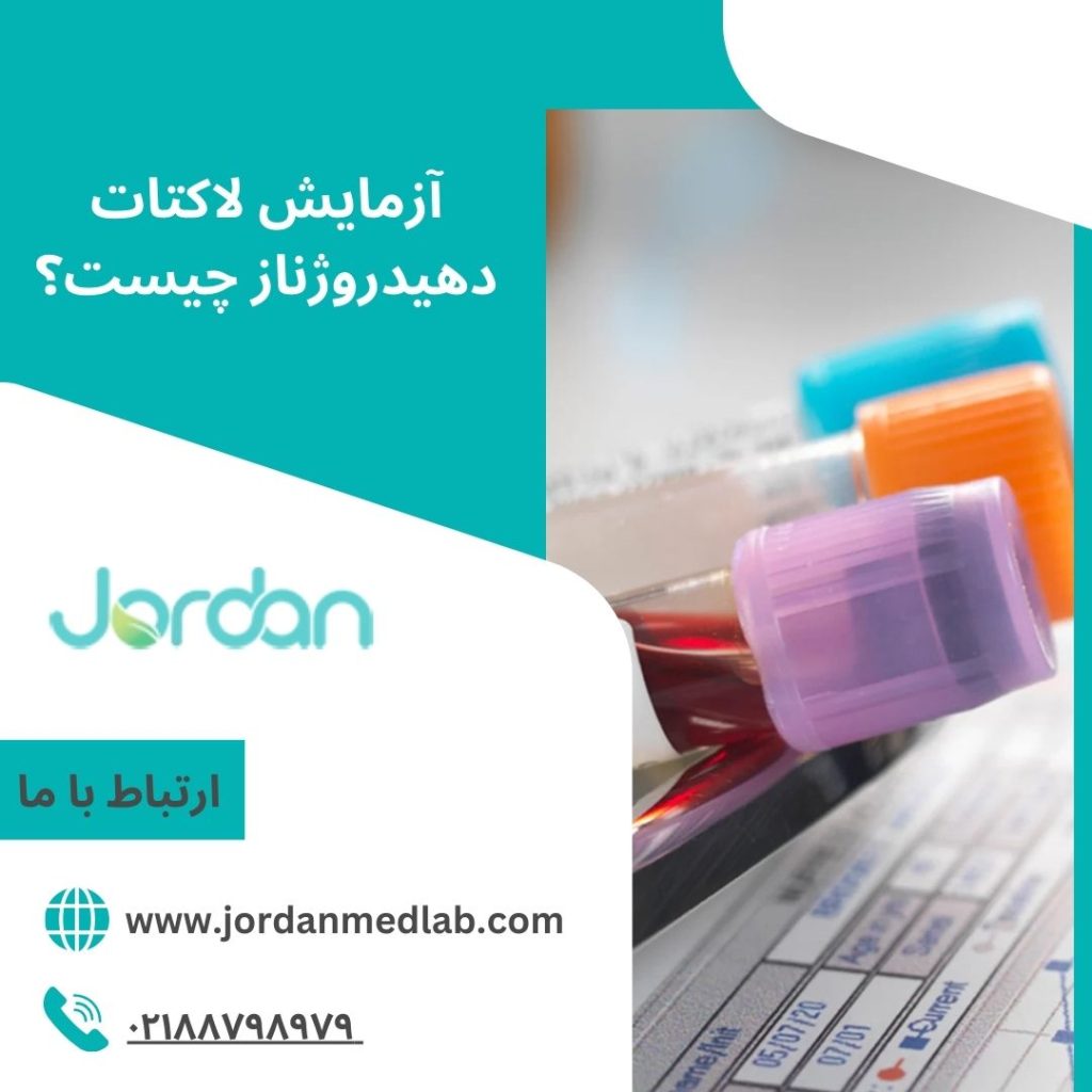 آزمایش لاکتات دهیدروژناز
