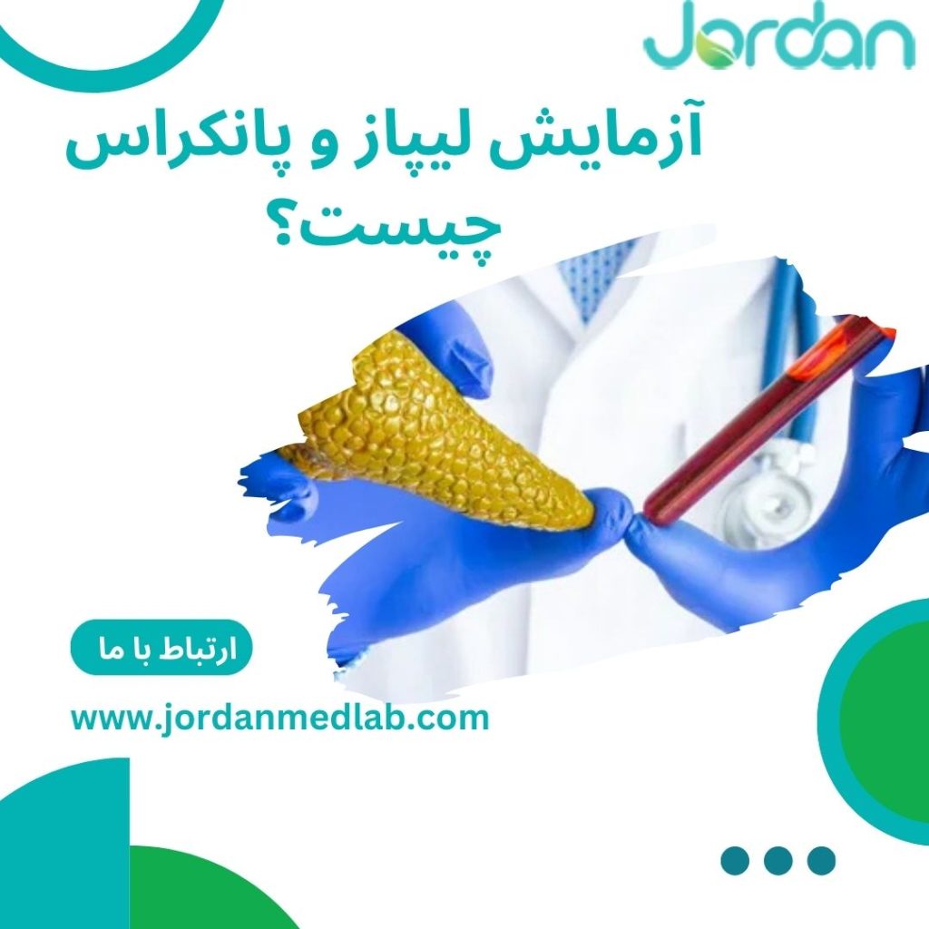 آزمایش لیپاز 