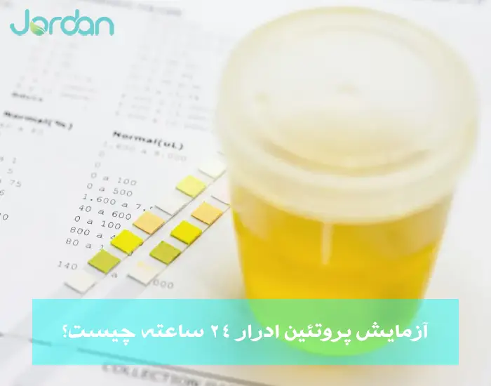 آزمایش پروتئین ادرار 24 ساعته