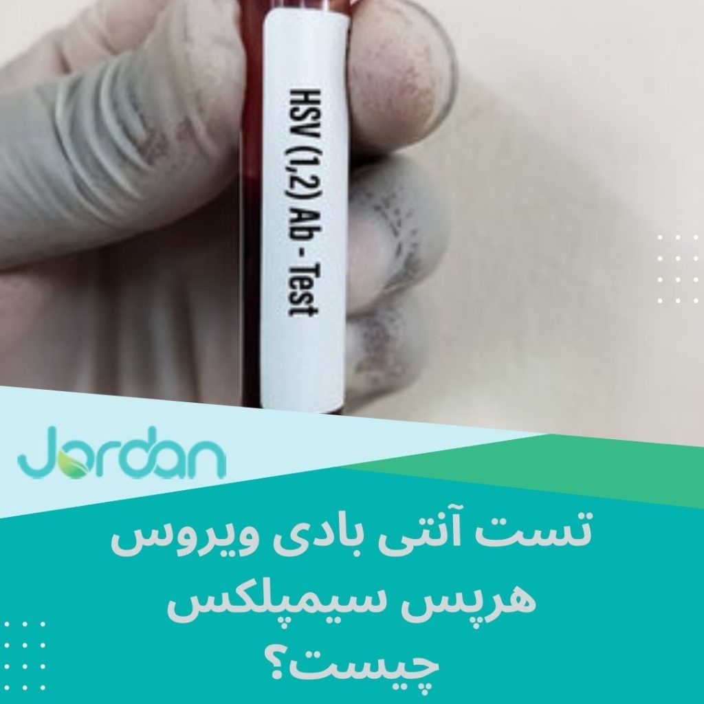 تست آنتی بادی ویروس هرپس سیمپلکس